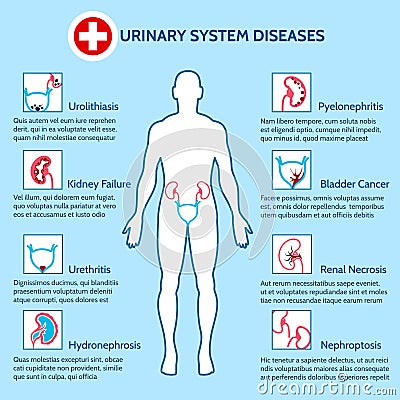 Urinary system diseases Vector Illustration