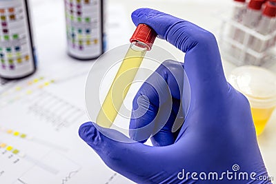 Urine bottle held by healthcare professionals with latex glove, toxicology test Stock Photo