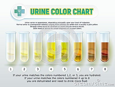 Urine Color Chart 1 Vector Illustration