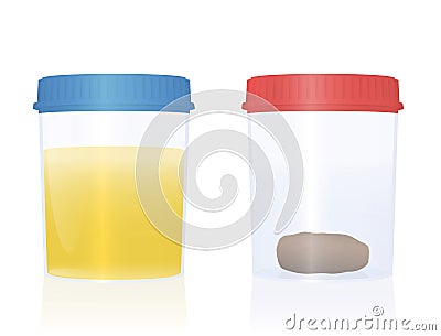 Urine Sample Fecal Specimen Stool Sample Cup Medical Examination Vector Illustration