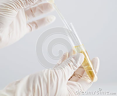 Urine sample Stock Photo