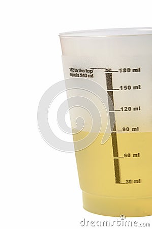 Urine Sample Stock Photo