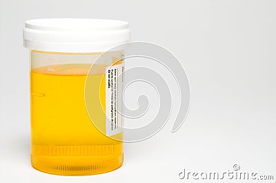 Urine Sample Stock Photo