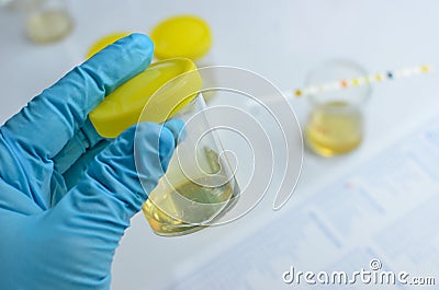 Urine sample Stock Photo