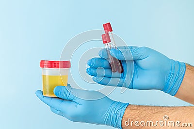 Urine sample and blood flask test in doctor or laboratory technician hands Stock Photo