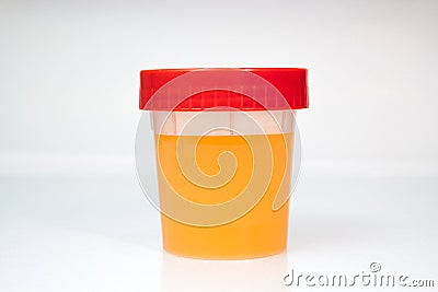 Urine Sample in closed transparent plastic can. Stock Photo