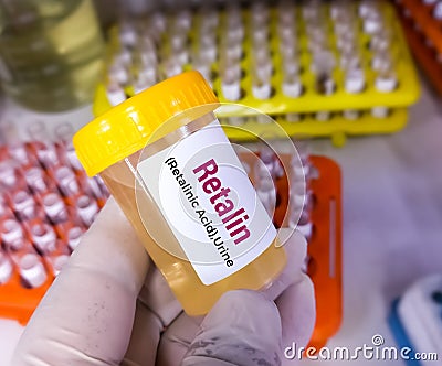 Urine sample for Methylphenidate or Retalin test. Stimulant used for attention deficit hyperactivity disorder Stock Photo