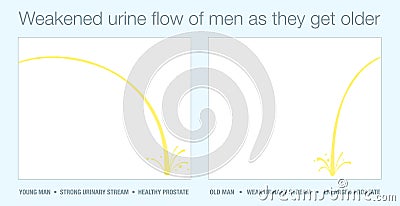 Urine Stream Enlarged Prostate Weak Strong Urinary Flow Young Old Man Vector Illustration