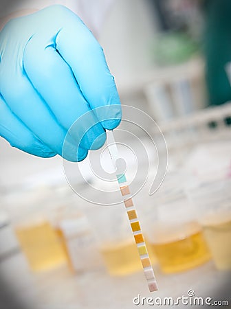 Urine test Stock Photo