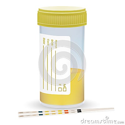 Urine Test Strip With The Plastic Jar Of Urine. Medical Examination On A White Background. Realistic Vector Vector Illustration