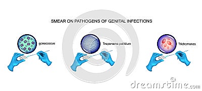 Urological smear, pathogens Vector Illustration