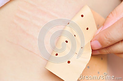 Using chinese rheumatism plaster Stock Photo