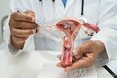 Uterus, doctor with anatomy model for study diagnosis and treatment in hospital Stock Photo