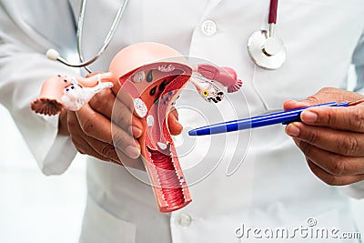 Uterus, doctor holding anatomy model for study diagnosis and treatment in hospital Stock Photo