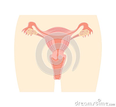 Uterus and ovaries, organs of female reproductive system Vector Illustration