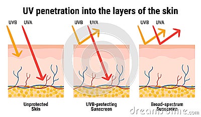 UV penetration into the layers of the skin. Infographic of sunscreen protection against UVA, UVB rays. Skin anatomy. Broad- Vector Illustration