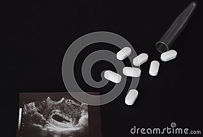 Uzi shot, pills and test tube on a black background, abortion, close-up Stock Photo