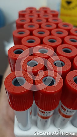 Vacum tube for serology test Stock Photo
