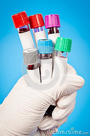 Vacuum tubes for collecting blood samples in the laboratory. Stock Photo