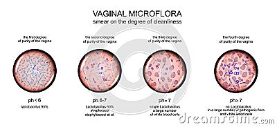 Vaginal microflora. degree of purity of the vagina Vector Illustration