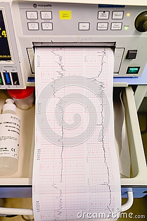 Valencia, Spain - October 25, 2018: Graphic with electrocardiogram of a pregnant woman during a hospital examination Editorial Stock Photo