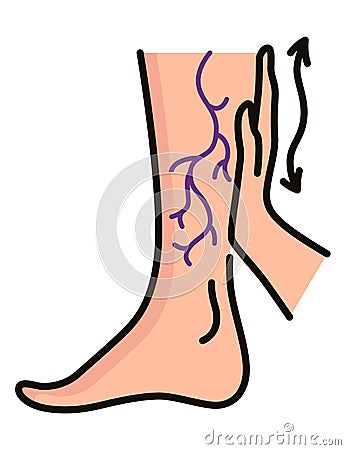 Varicose treatment icon. Violation of circulatory system. Vascular disease diagnostic. Venous insufficiency medical Vector Illustration