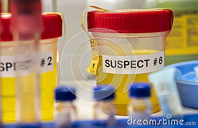 Various analyses of urine, saliva and blood of homicide suspects in crime lab Stock Photo