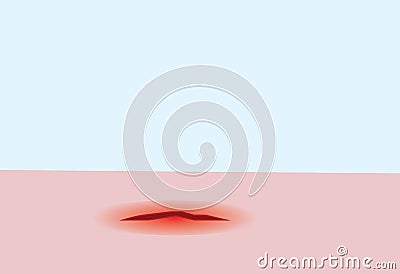 Vector of bleeding wound on the skin Vector Illustration