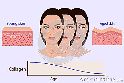 Vector face and two types of skin - aged and young for medical and cosmetological illustrations Vector Illustration