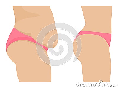 Vector female abdomen before after losing weight Vector Illustration