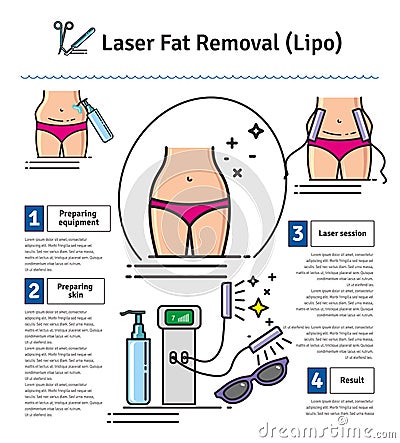 Vector Illustrated set with Laser LIPO Fat Removal Vector Illustration