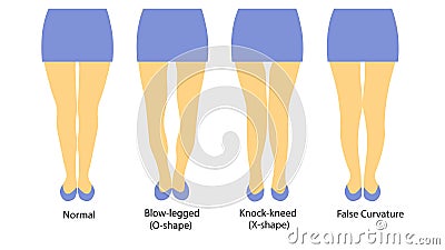 Vector illustration with different shapes of women legs Vector Illustration