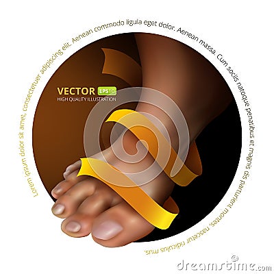 Vector illustration of foot fungus Vector Illustration