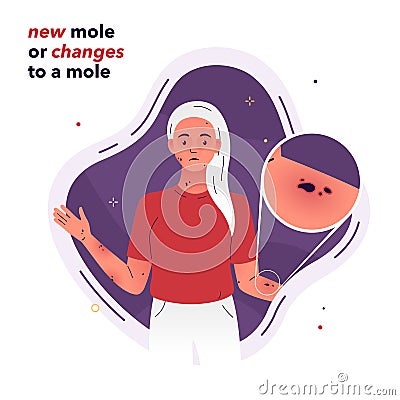 Vector illustration of a girl with moles all over her body. Changes in a mole are symptoms of a hormonal imbalance, an Vector Illustration