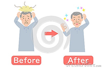 Before-after vector illustration of Grandpa suffering from dandruff of the scalp Vector Illustration