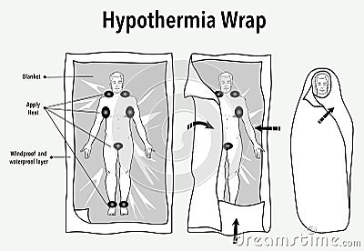 Vector illustration of a hypothermia wrap and first aid Vector Illustration