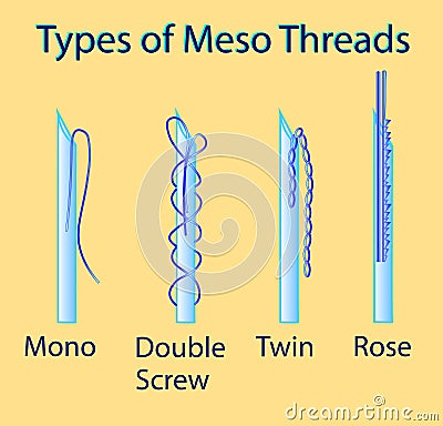 Vector illustration with types of meso threads Vector Illustration