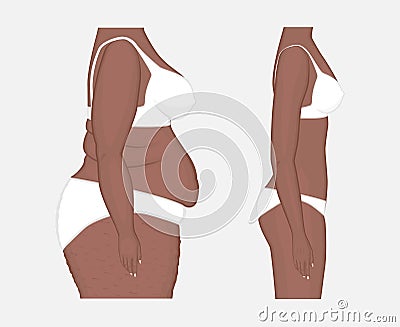 Human body problem_Body weight loss of African American women fr Vector Illustration