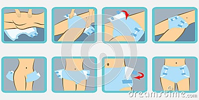 Instructions on how to put adult diapers Stock Photo