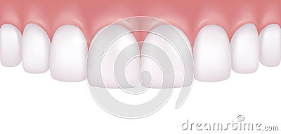 Vector realistic row of white and atraight upper teeth - dentist Vector Illustration