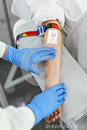 Vein Scanning. Patient Hand With Veins Mapping Closeup Stock Photo