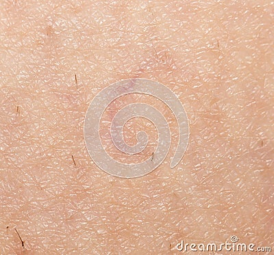 Veins on the skin. close Stock Photo