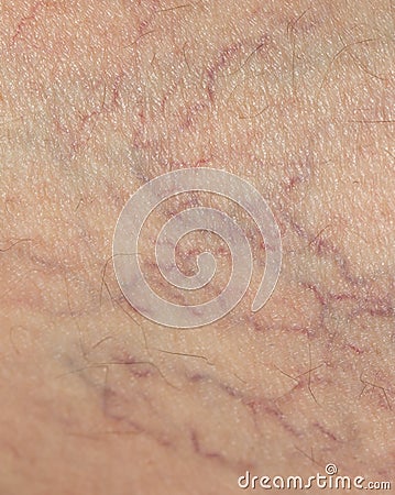 Veins on the skin. close Stock Photo