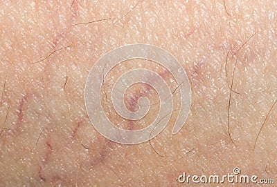 Veins on the skin. close Stock Photo