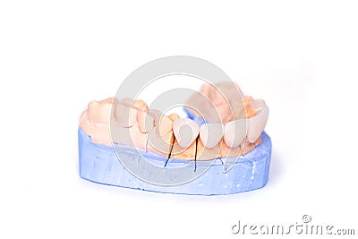 Veneers and crowns isolated on white background. Plaster model of teeth. lower jaw plaster model with prepared teeth Stock Photo