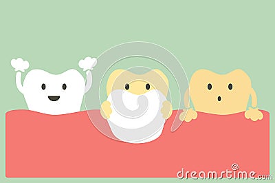 Veneers teeth Vector Illustration