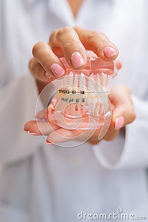 Vertical detail cropped shot of unrecognizable female orthodontist doctor in white coat holding human jaws layout model Stock Photo