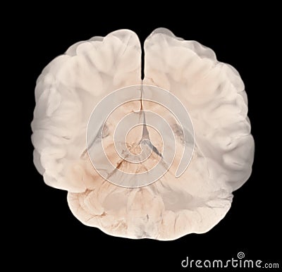 Vertical Section Through Cerebral Hemispheres. Human Brain Anatomy Stock Photo