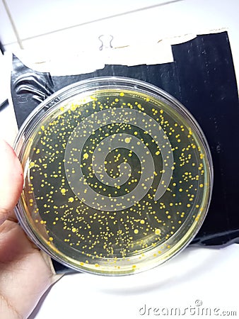 Vibrio bacterial with yellow colony in the TCBS agar Stock Photo