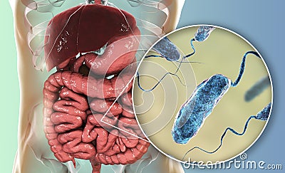 Vibrio cholerae bacteria in small intestine Cartoon Illustration